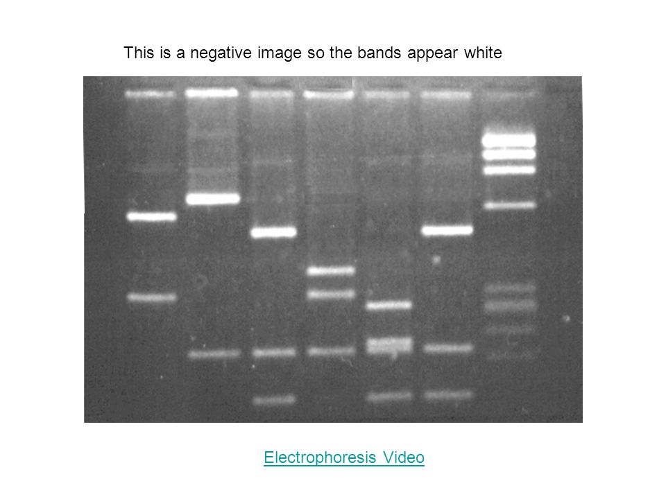 This is a negative image so the bands appear white Electrophoresis Video