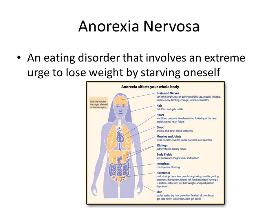 What foods to never eat if you want to lose weight image 10