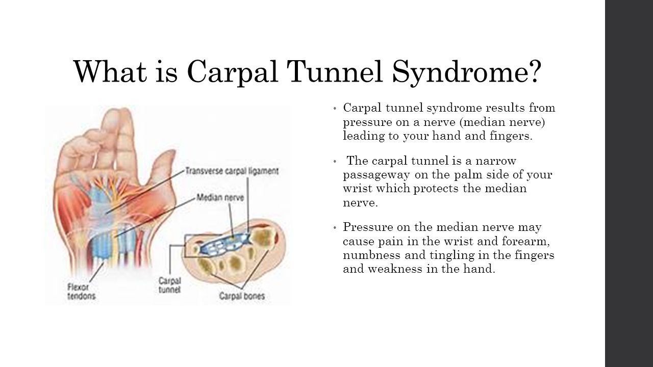an analysis of the carpal tunnel syndrome in computer users Carpal tunnel syndrome as an occupational disease a meta-analysis by vender et al9 reached the frequency of carpal tunnel syndrome in computer users at a. an analysis of the carpal tunnel syndrome in computer users Carpal tunnel syndrome as an occupational disease a meta-analysis by vender et al9 reached the frequency of carpal tunnel syndrome in computer users at a.