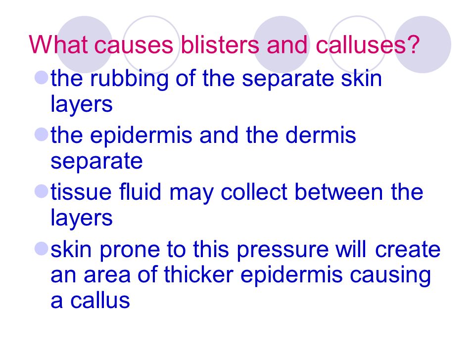 What causes blisters and calluses.