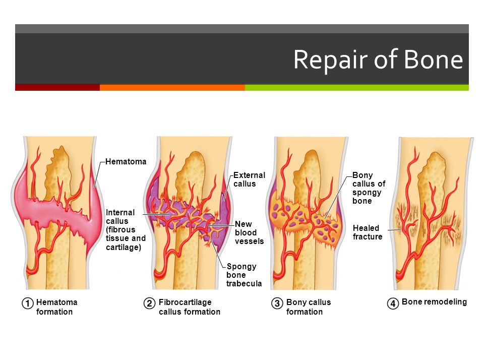 callus formation – lickclick callus formation – lickclick, Muscles