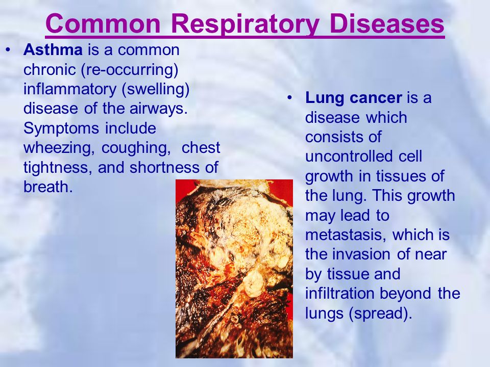 Common Respiratory Diseases Asthma is a common chronic (re-occurring) inflammatory (swelling) disease of the airways.