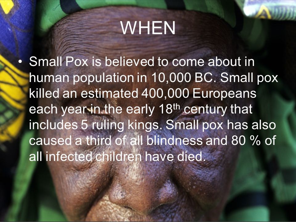 smallpox around the world essay For centuries, smallpox killed millions of people around the world but thanks to global immunization programs, the deadly infectious disease was wiped out in the late 1970s. smallpox around the world essay For centuries, smallpox killed millions of people around the world but thanks to global immunization programs, the deadly infectious disease was wiped out in the late 1970s.