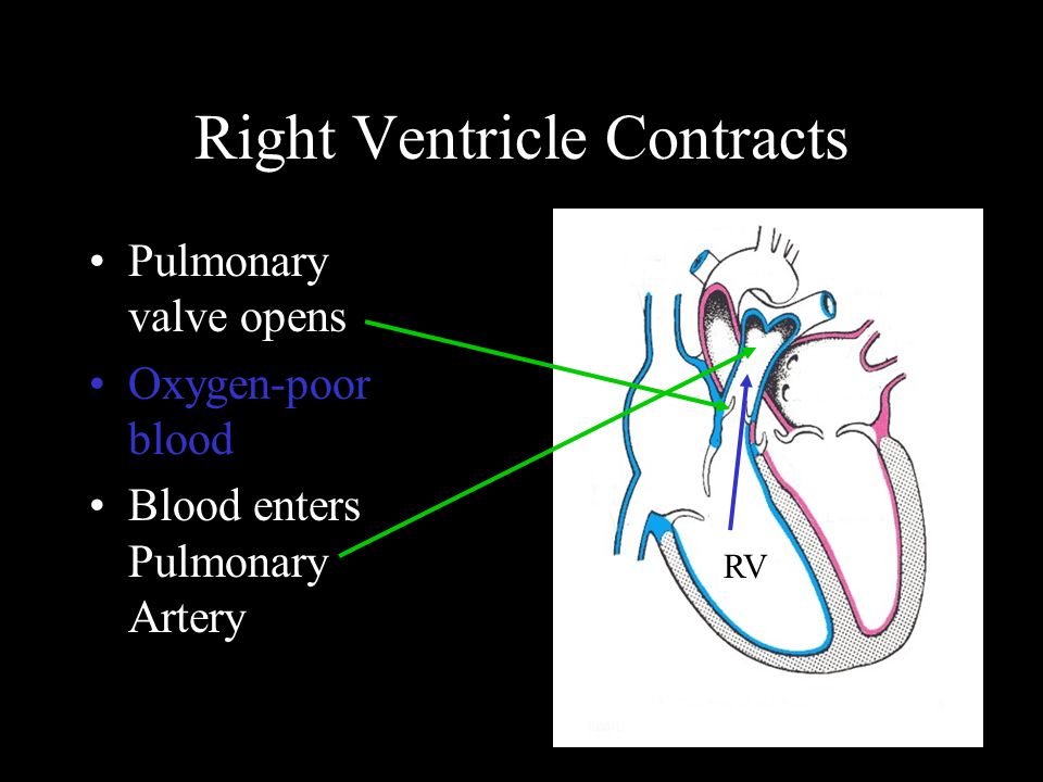 Right Ventricle Contracts Pulmonary valve opens Oxygen-poor blood Blood enters Pulmonary Artery RV