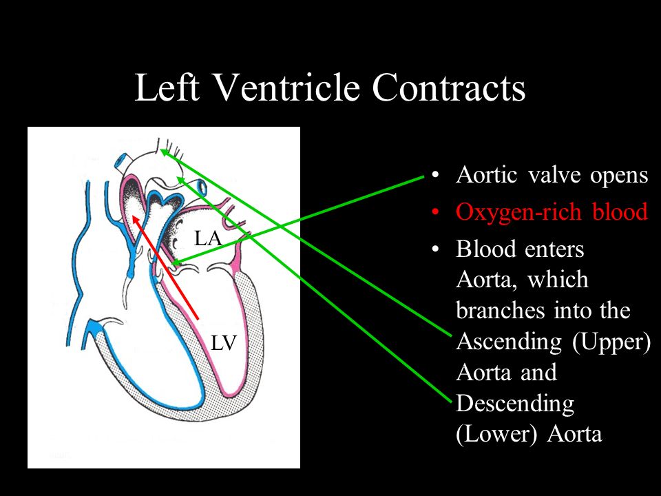 Left Ventricle Contracts Aortic valve opens Oxygen-rich blood Blood enters Aorta, which branches into the Ascending (Upper) Aorta and Descending (Lower) Aorta RV LA LV