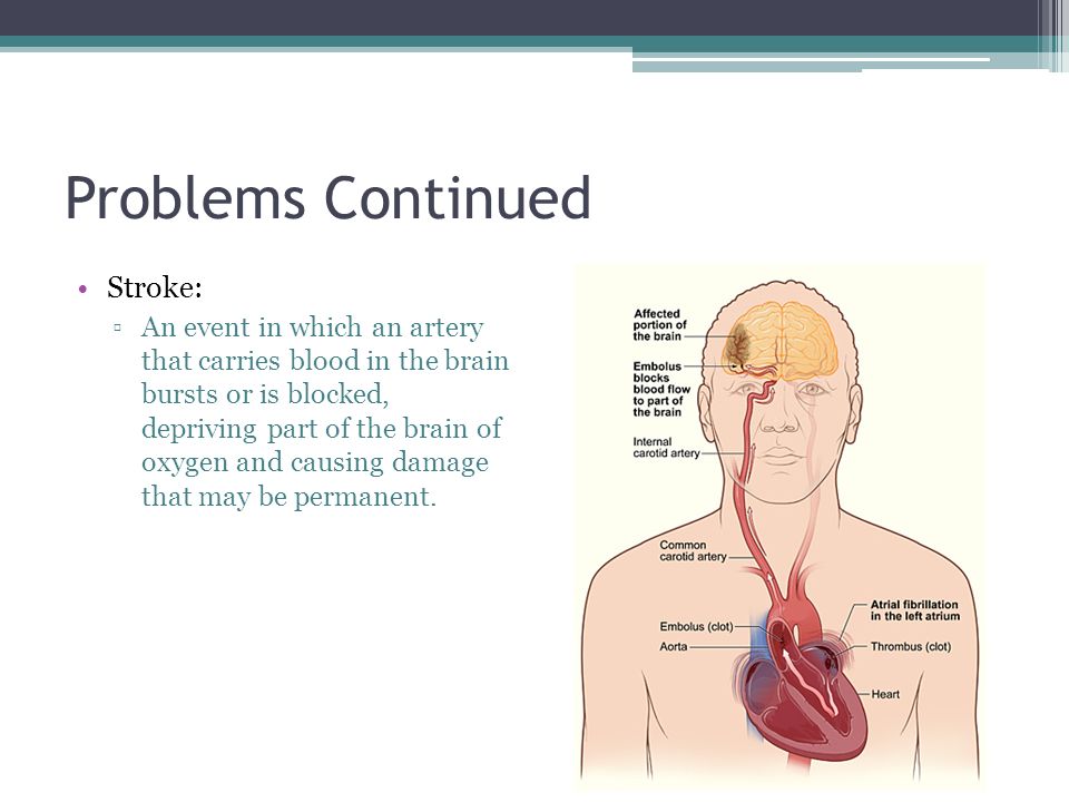 Problems Continued Stroke: ▫An event in which an artery that carries blood in the brain bursts or is blocked, depriving part of the brain of oxygen and causing damage that may be permanent.