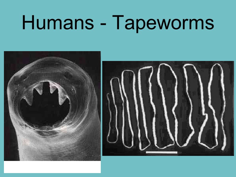 Humans - Tapeworms