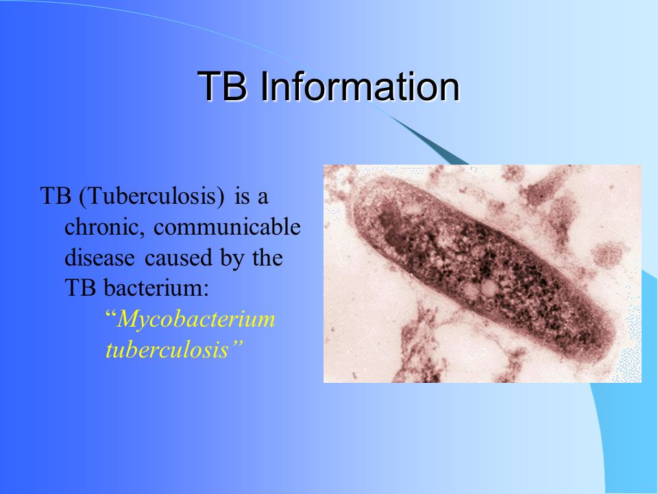 tuberculosis presentation tuberculosis tuberculosis presentation tuberculosis