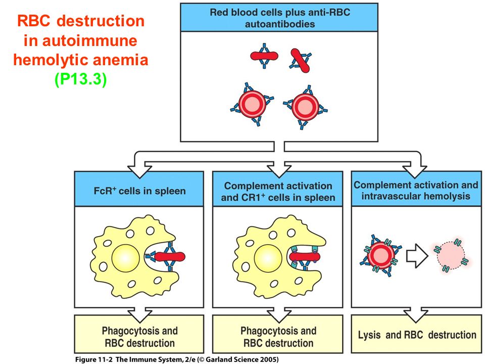 Figure 11-2 RBC destruction in autoimmune hemolytic anemia (P13.3)