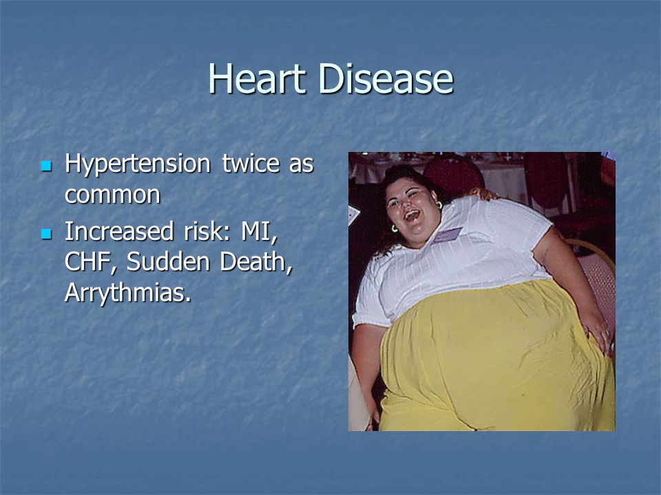 Arrythmias associated with morbid obesity