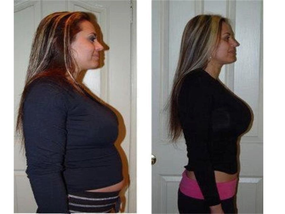Synthroid Cytomel Weight Loss