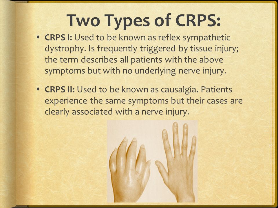 crps pictures