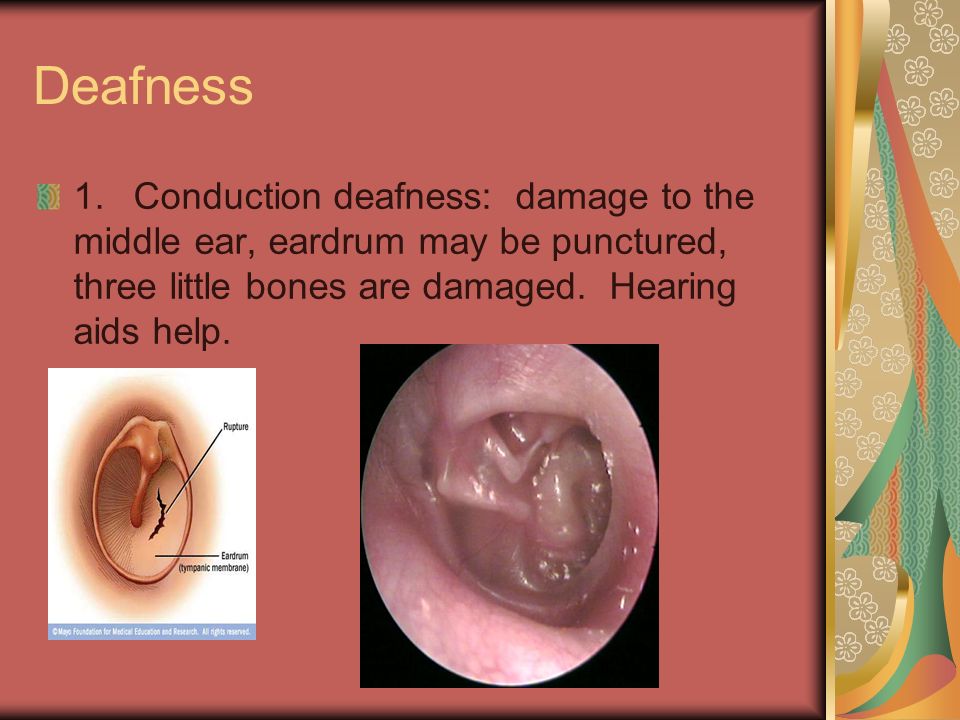 damaged ear