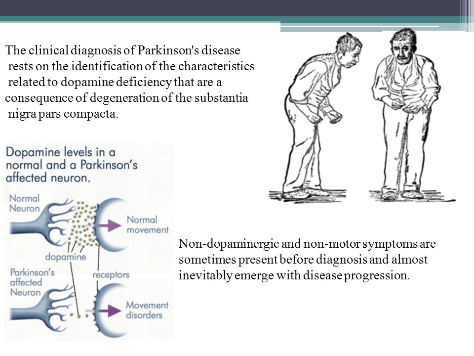 characteristics and treatments of parkinsons disease characteristics and treatments of parkinsons disease
