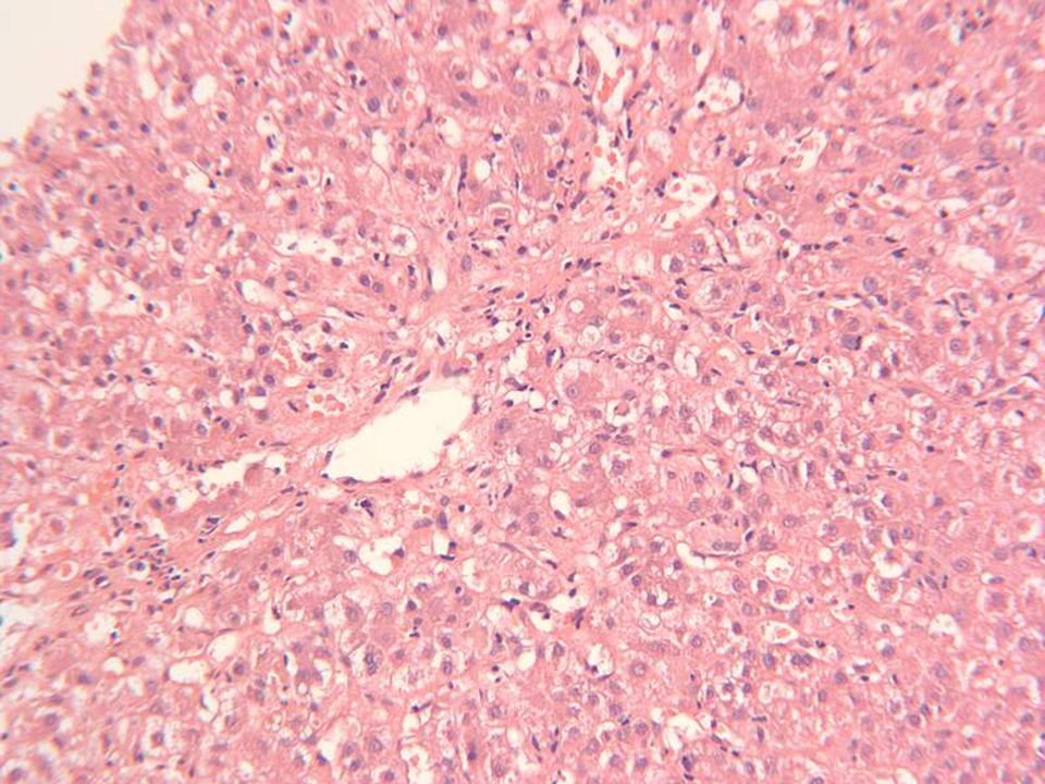 liver slide