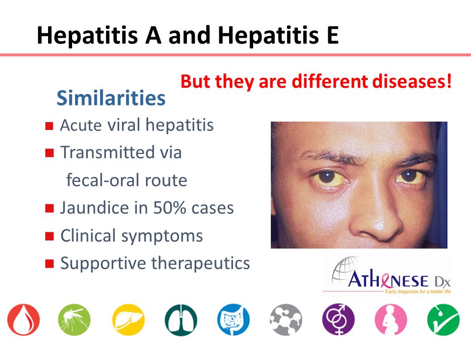 Acute viral hepatitis Transmitted via fecal-oral route Jaundice in 50% cases Clinical symptoms - slide_2