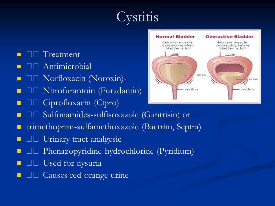 Cipro For Urinary Tract Infections