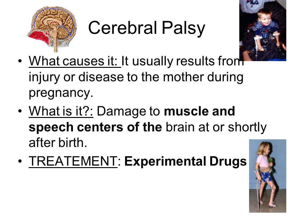 cerebral palsy For most parents, when they receive a diagnosis of cerebral palsy for their child they experience confusion and strong emotions every parent searches for th. cerebral palsy For most parents, when they receive a diagnosis of cerebral palsy for their child they experience confusion and strong emotions every parent searches for th.