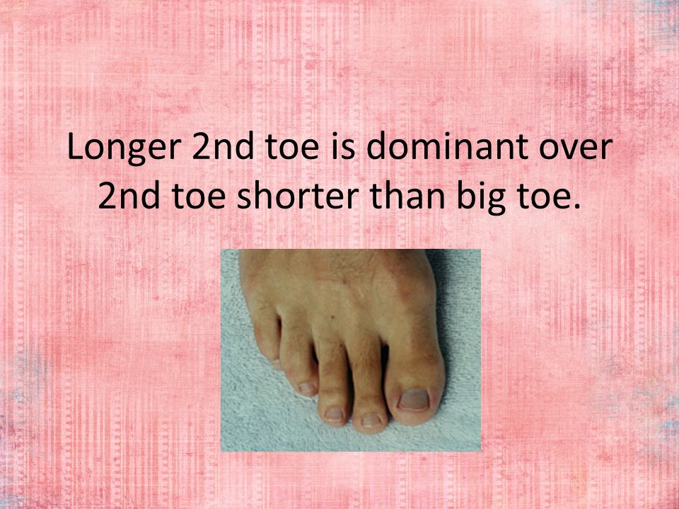 Blonde Hair Dominant Or Recessive Gene You Could Carry One Dominant And Recessive Gene Have Brown