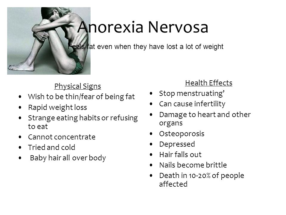 Weight loss headaches image 2
