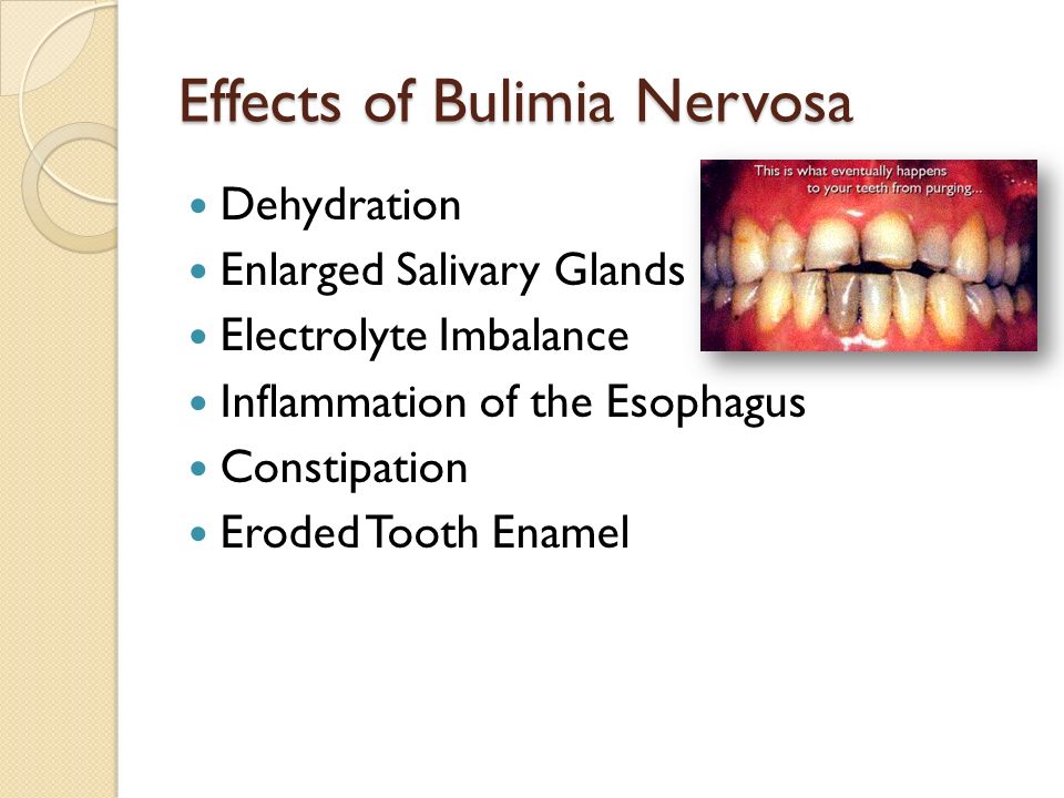 an introduction to the disease bulimia a serious eating disorder How eating disorders can affect young athletes competitors are at risk for anorexia, bulimia and binge eating. an introduction to the disease bulimia a serious eating disorder How eating disorders can affect young athletes competitors are at risk for anorexia, bulimia and binge eating.