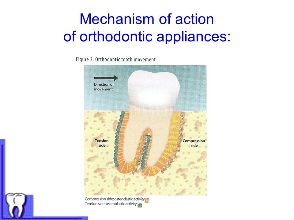 Mechanism of action of orthodontic appliances: