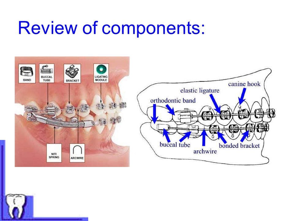 Review of components:
