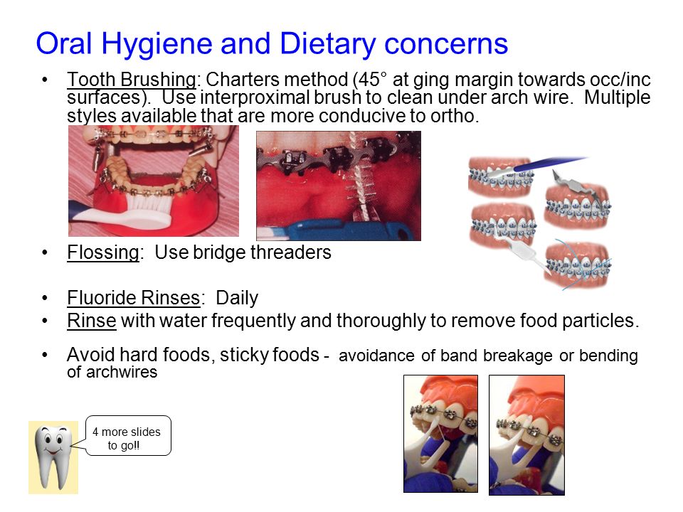 Oral Hygiene and Dietary concerns Tooth Brushing: Charters method (45° at ging margin towards occ/inc surfaces).