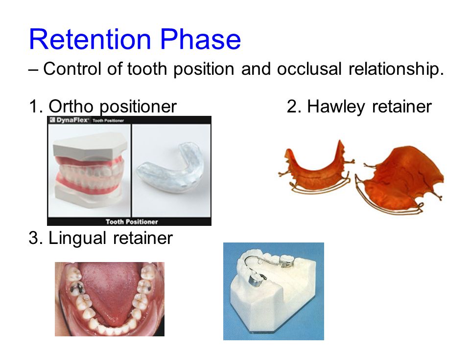 Retention Phase –Control of tooth position and occlusal relationship.