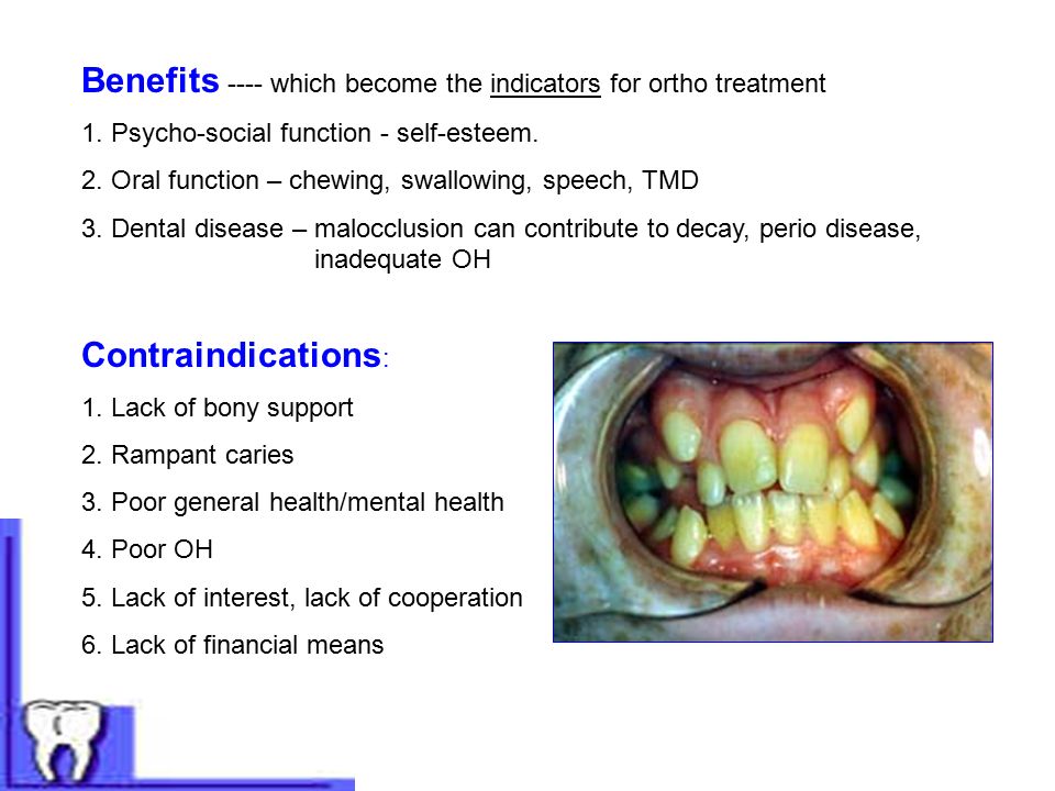 Benefits ---- which become the indicators for ortho treatment 1.