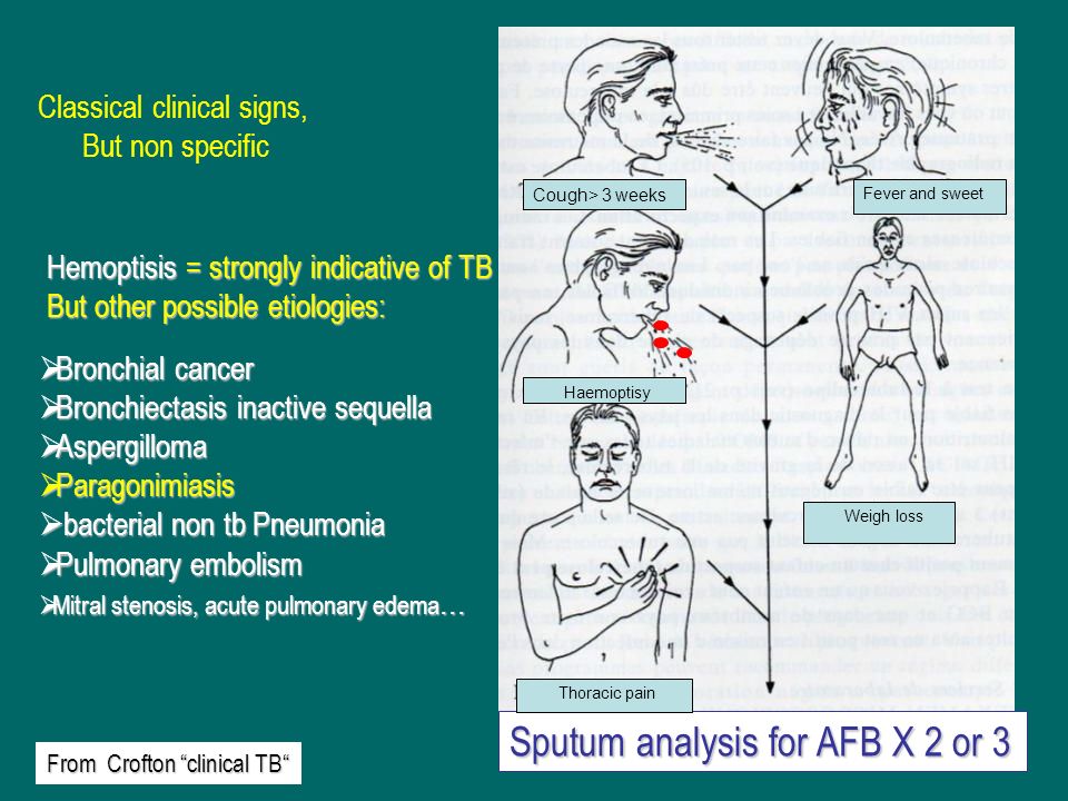Bronchiectasis cancer