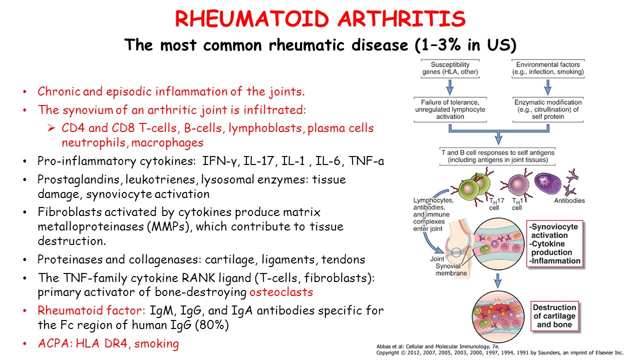 RHEUMATOID ARTHRITIS The most common rheumatic disease (1–3% in US) Chronic and episodic inflammation of the joints.