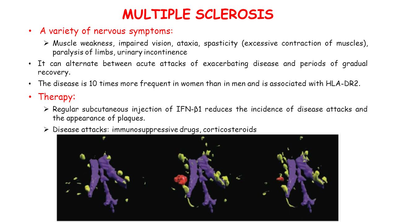MULTIPLE SCLEROSIS A variety of nervous symptoms:  Muscle weakness, impaired vision, ataxia, spasticity (excessive contraction of muscles), paralysis of limbs, urinary incontinence It can alternate between acute attacks of exacerbating disease and periods of gradual recovery.