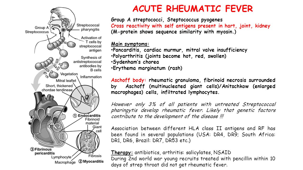 ACUTE RHEUMATIC FEVER Group A streptococci, Steptococcus pyogenes Cross reactivity with self antigens present in hart, joint, kidney (M-protein shows sequence similarity with myosin.) Main symptoms: Pancarditis, cardiac murmur, mitral valve insufficiency Polyarthritis (joints become hot, red, swollen) Sydenham’s chorea Erythema marginatum (rash) Aschoff body: rheumatic granuloma, fibrinoid necrosis surrounded by Aschoff (multinucleated giant cells)/Anitschkow (enlarged macrophages) cells, infiltrated lymphocytes.