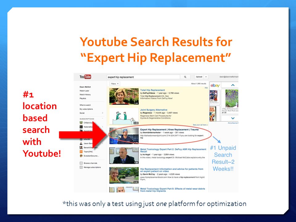 Youtube Search Results for Expert Hip Replacement #1 location based search with Youtube.
