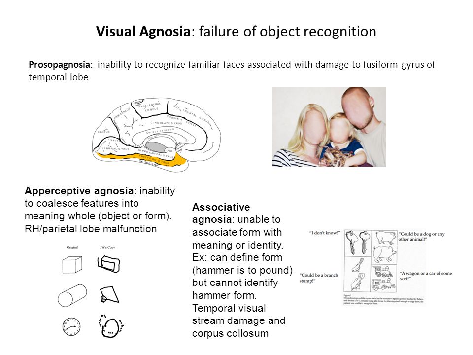 chapter 3 sensation and perception sensation activity of receptor visual form agnosia