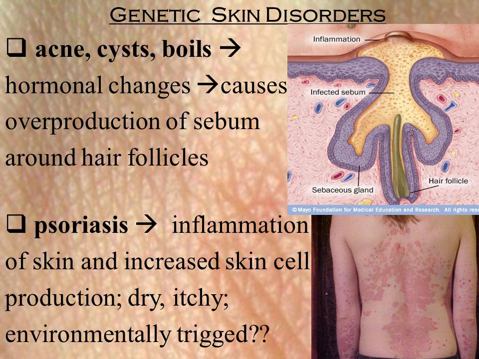 psoriasis a disease affecting the integumentary All-natural is psoriasis a disease of the integumentary system iron eczema treatment naturasil for eczema is an all-natural treatment for eczema that is fast. psoriasis a disease affecting the integumentary All-natural is psoriasis a disease of the integumentary system iron eczema treatment naturasil for eczema is an all-natural treatment for eczema that is fast.