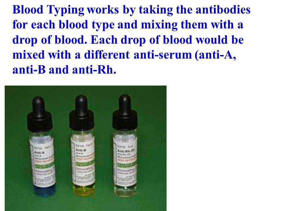blood typing blood type is based on the presence or absence of 2 how blood typing works