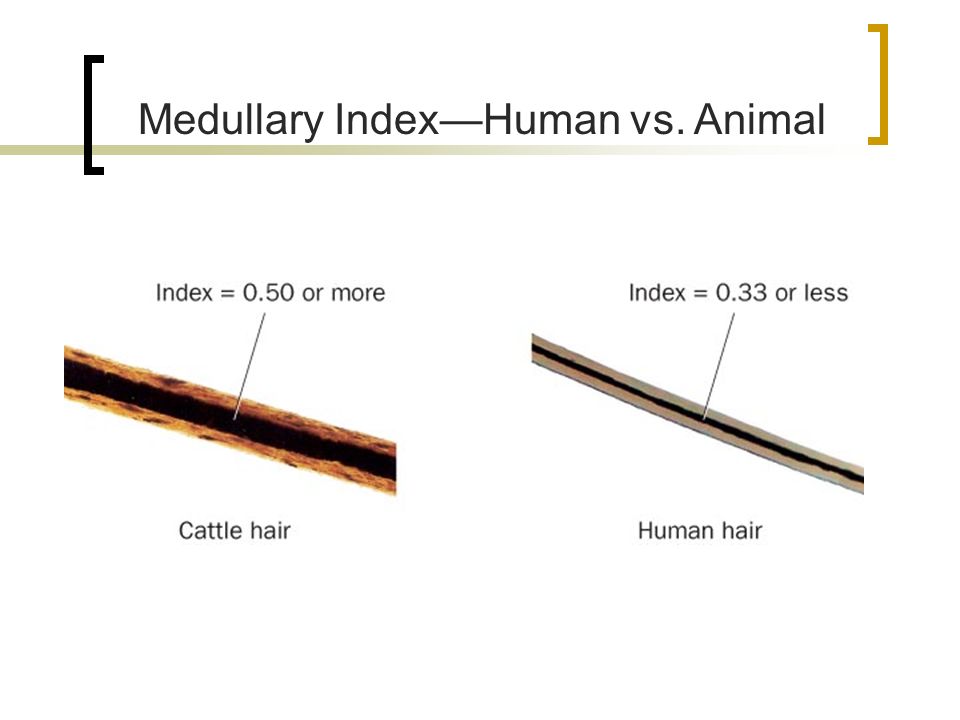 Human Hair Vs Animal Hair Factory Sale, 54% OFF 