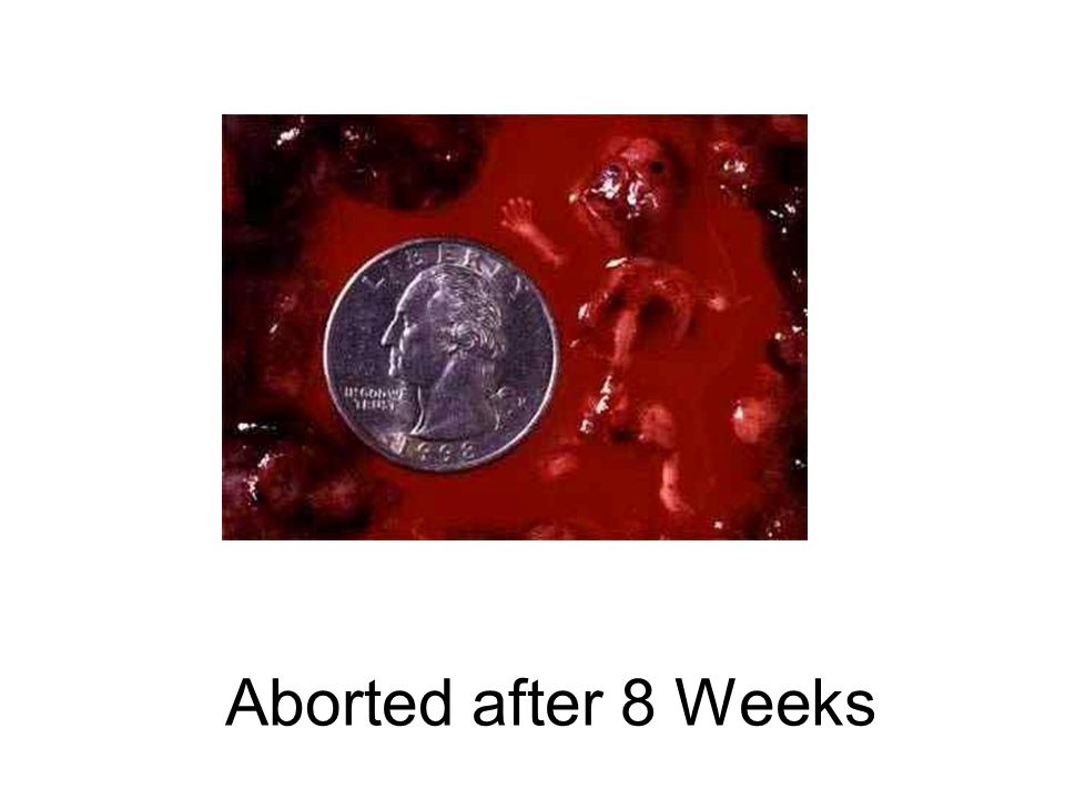 Aborted after 8 Weeks