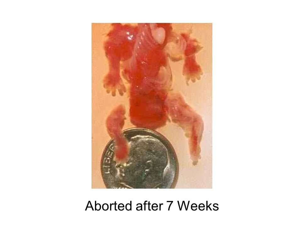 Aborted after 7 Weeks