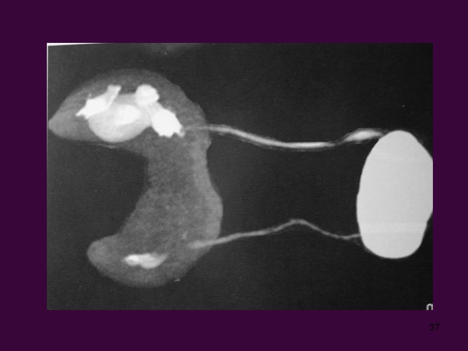 combivent vs combivent respimat dosing combivent dose pediatric
