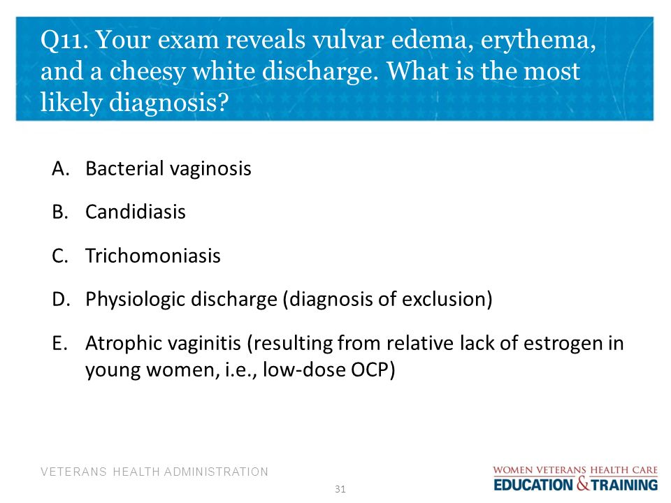 symptoms of too much synthroid symptoms of too much synthroid