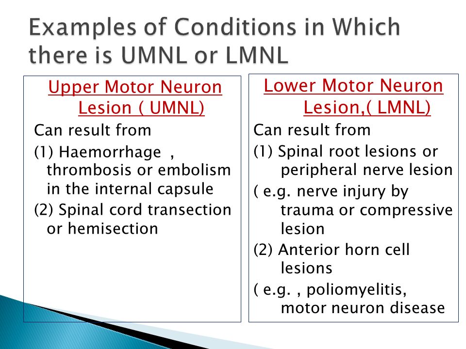 upper motor neuron lesion