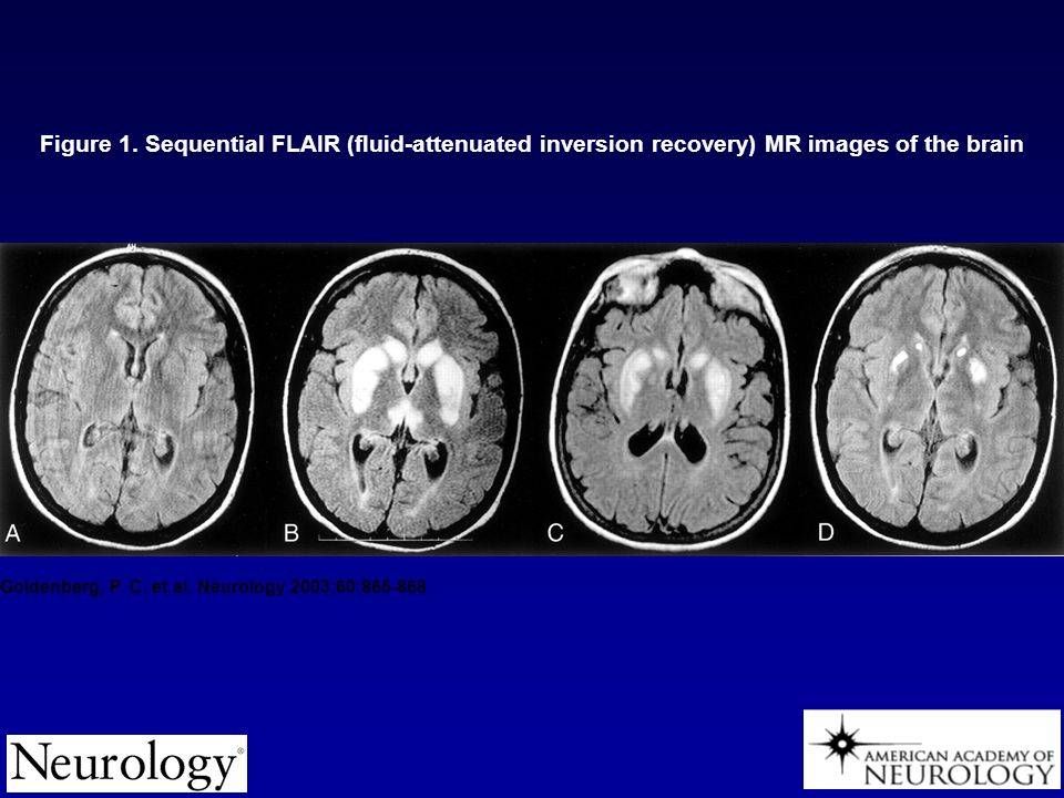 Goldenberg, P. C. et al. Neurology 2003;60: Figure 1.