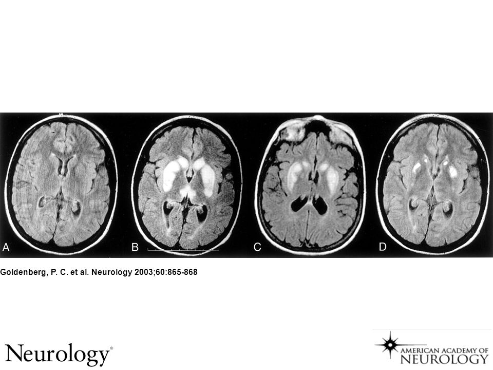 Goldenberg, P. C. et al. Neurology 2003;60: Figure 1.