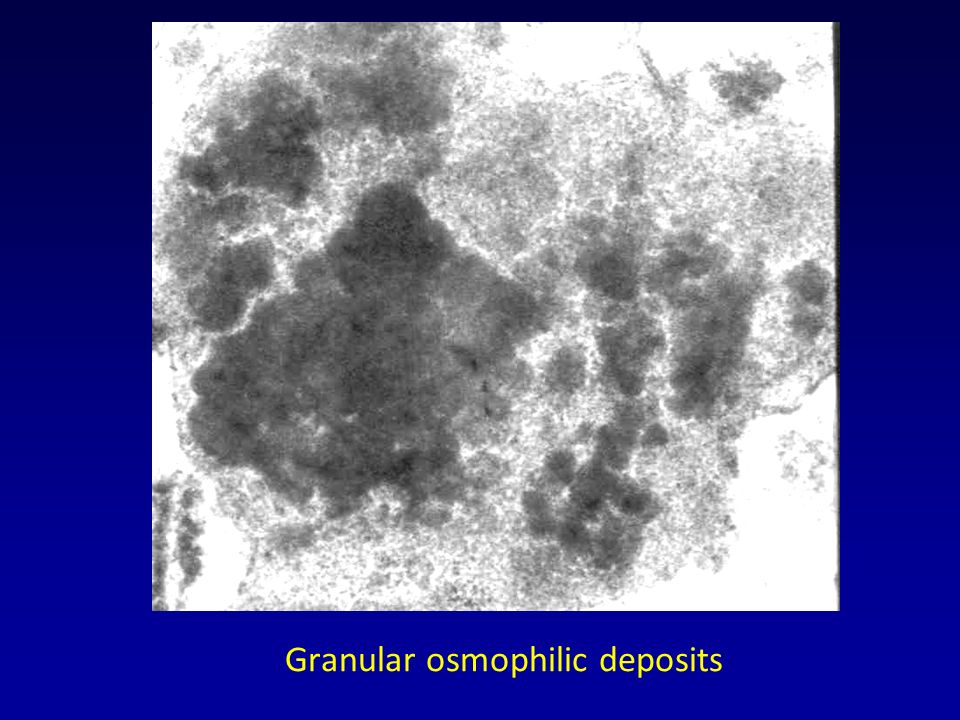 Granular osmophilic deposits