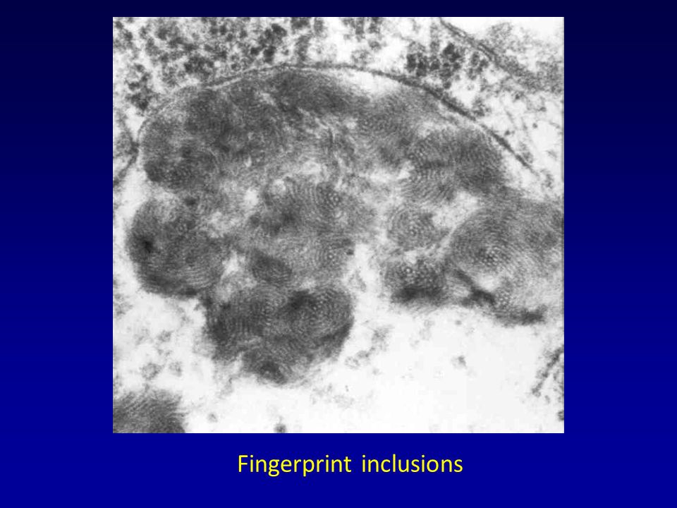 Fingerprint inclusions