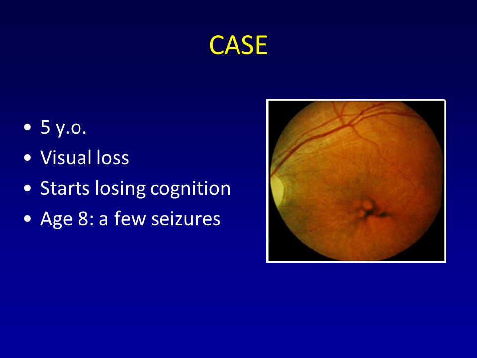 CASE 5 y.o. Visual loss Starts losing cognition Age 8: a few seizures