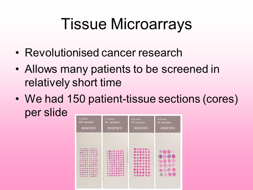 Tissue Microarrays Revolutionised cancer research Allows many patients to be screened in relatively short time We had 150 patient-tissue sections (cores) per slide